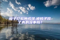 蚊子叮脸肿成球,被蚊子咬了真的没事吗？